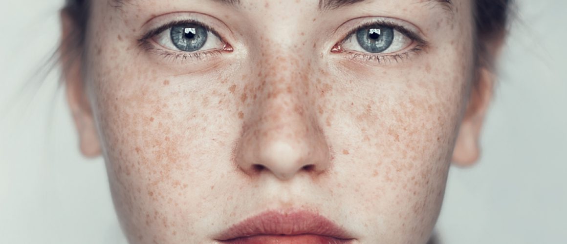 Girl-with-freckles-shutterstock-102716